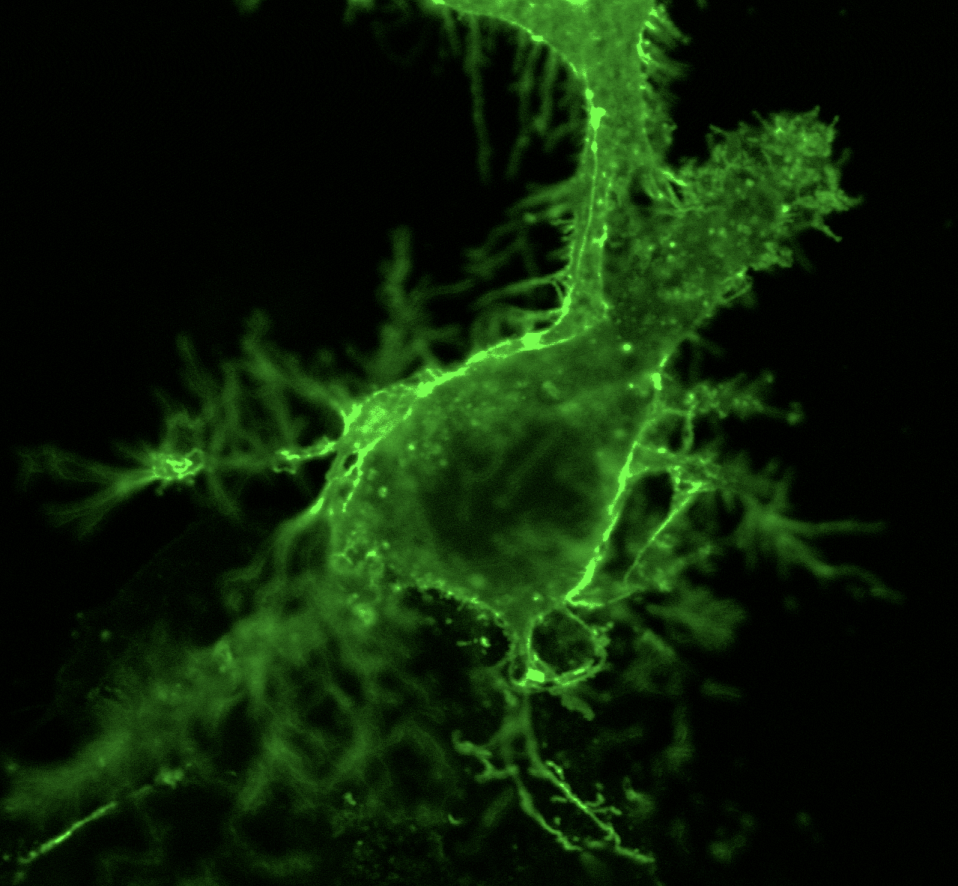 Fluorescence microscopy image of GFP fusion protein localization