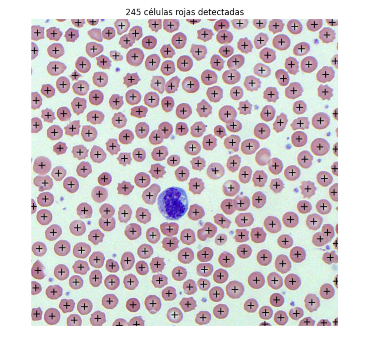 Microscopy image showing detected red blood cells and their predicted locations